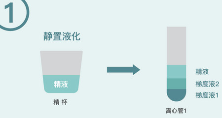 试管婴儿中的“洗精”是一项什么技术？有几种