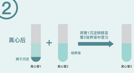 试管婴儿中的“洗精”是一项什么技术？有几种