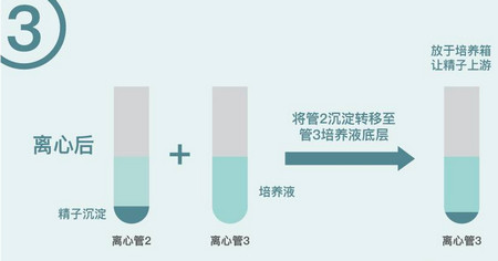 试管婴儿中的“洗精”是一项什么技术？有几种