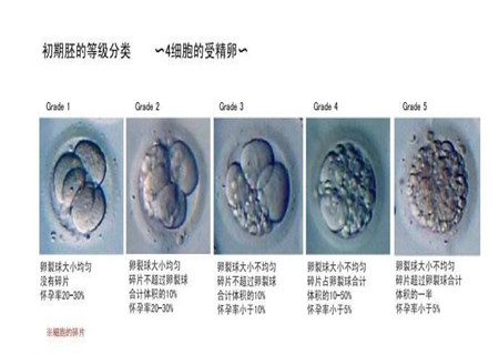 试管婴儿胚胎几级最好-杰特宁试管知识