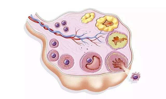 卵泡黄素化的原因及症状表现